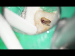 치아 RA는 텅스텐 카바이드 절삭기 치아의 사용 저속도를 가시를 없앱니다